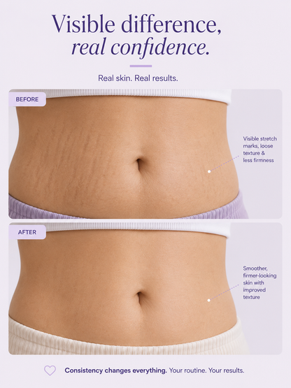SilkBelly - Tightening & Smoothening Belly Cream